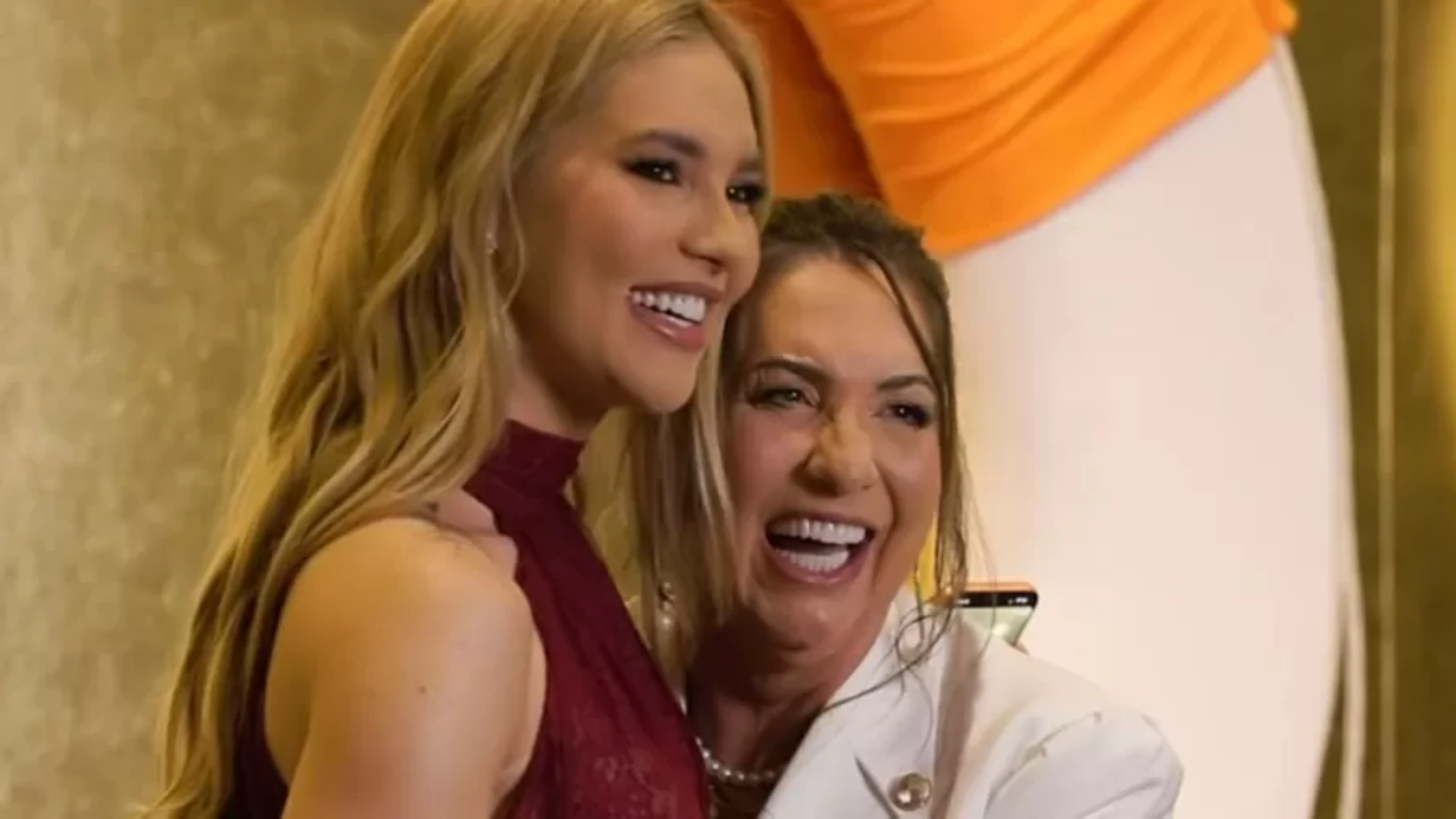 Mudou muito? Mãe de Virignia passa por transformação após procedimento estético