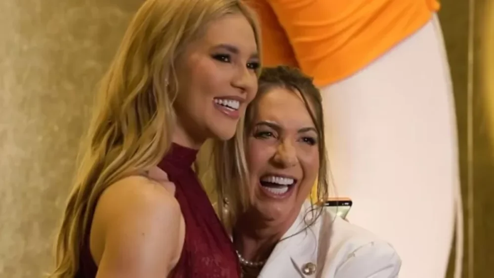 Mudou muito? Mãe de Virignia passa por transformação após procedimento estético