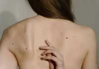 When to Check Moles and What Dermatologists Look for in Every Skin Spot: A Comprehensive Guide to Skin Health and Cancer Prevention.